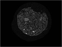 iberulite_nano_ct.pdf
